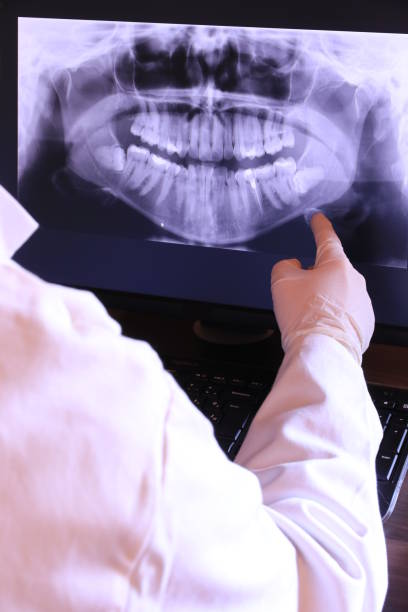Best Emergency Treatment for Oral Infections in North Patchogue, NY